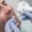 Dental Fillings in Rawalpindi Islamabad