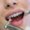 Teeth Whitening Prices in Pakistan
