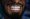 Hollywood Smile Design in Islamabad