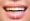 Teeth Scaling in Islamabad Pakistan