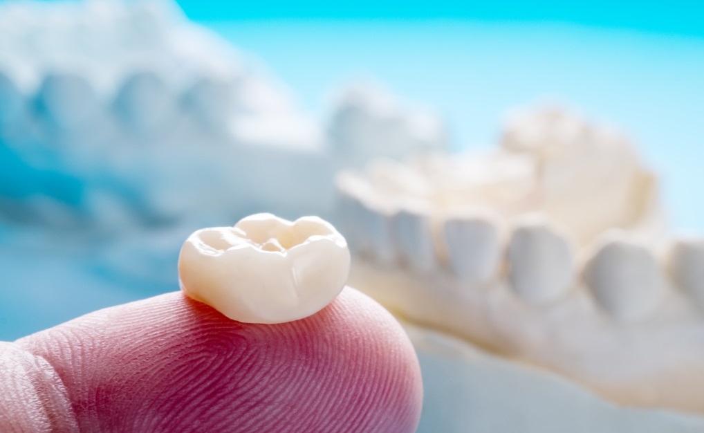 dental crowns in Islamabad