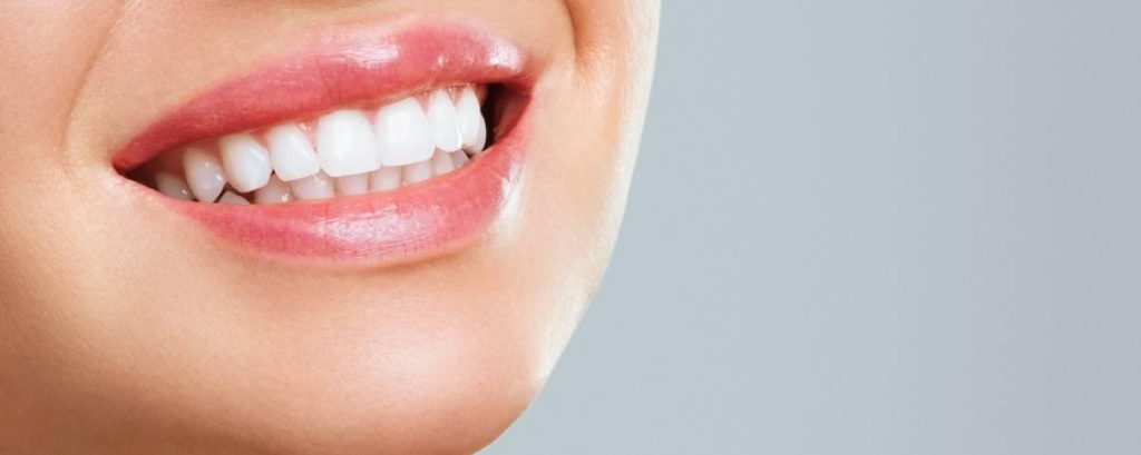 Why choose a Perfect Hollywood Smile?
