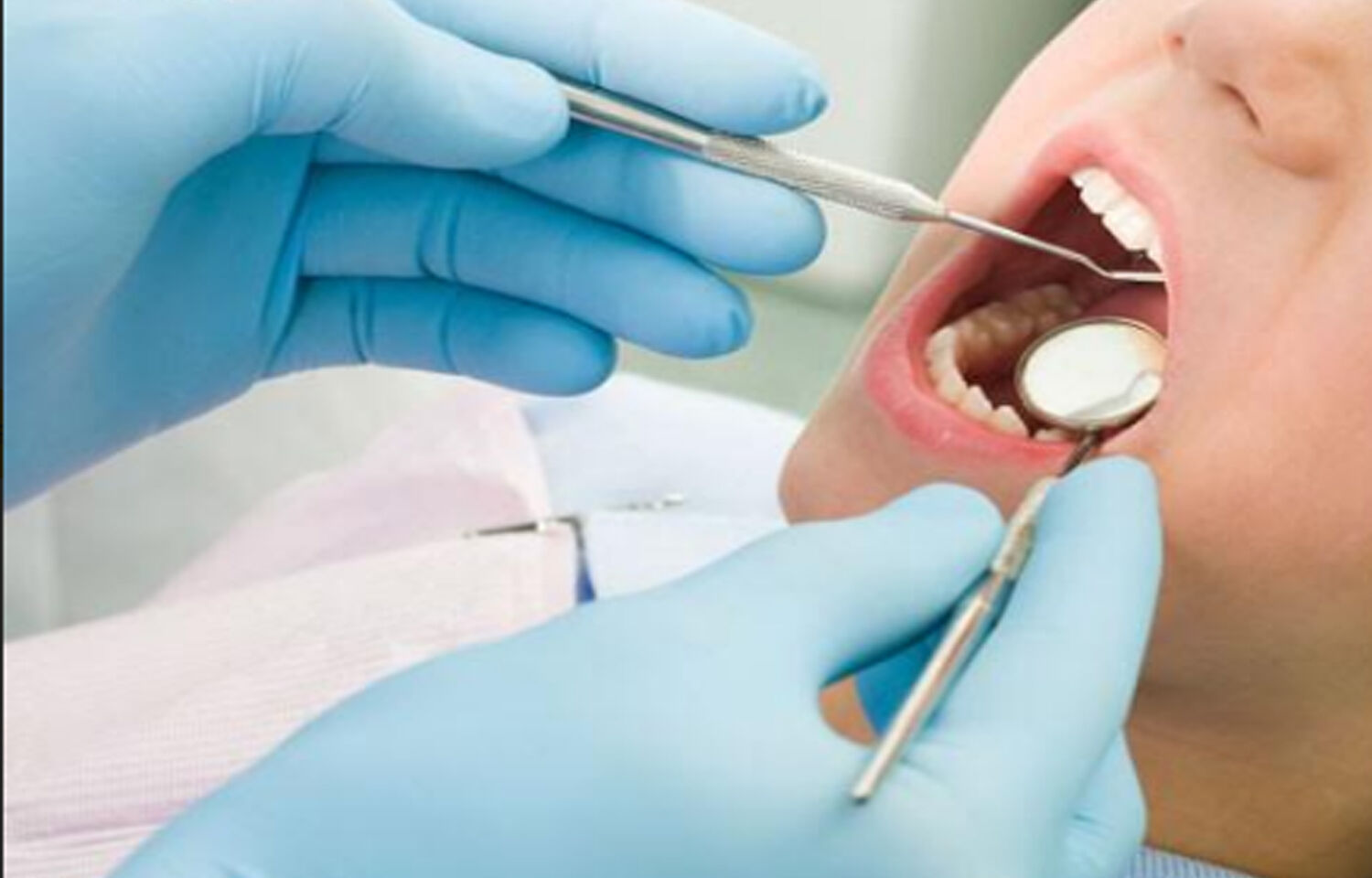 What is the most popular cosmetic dental procedure?