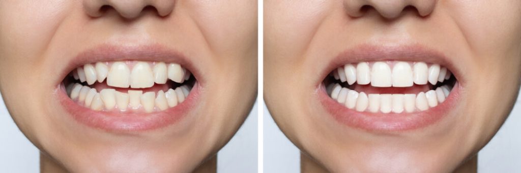How Can Periodontics Help Save Your Teeth?