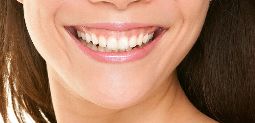 How Do Dentists Correct a Gummy Smile?