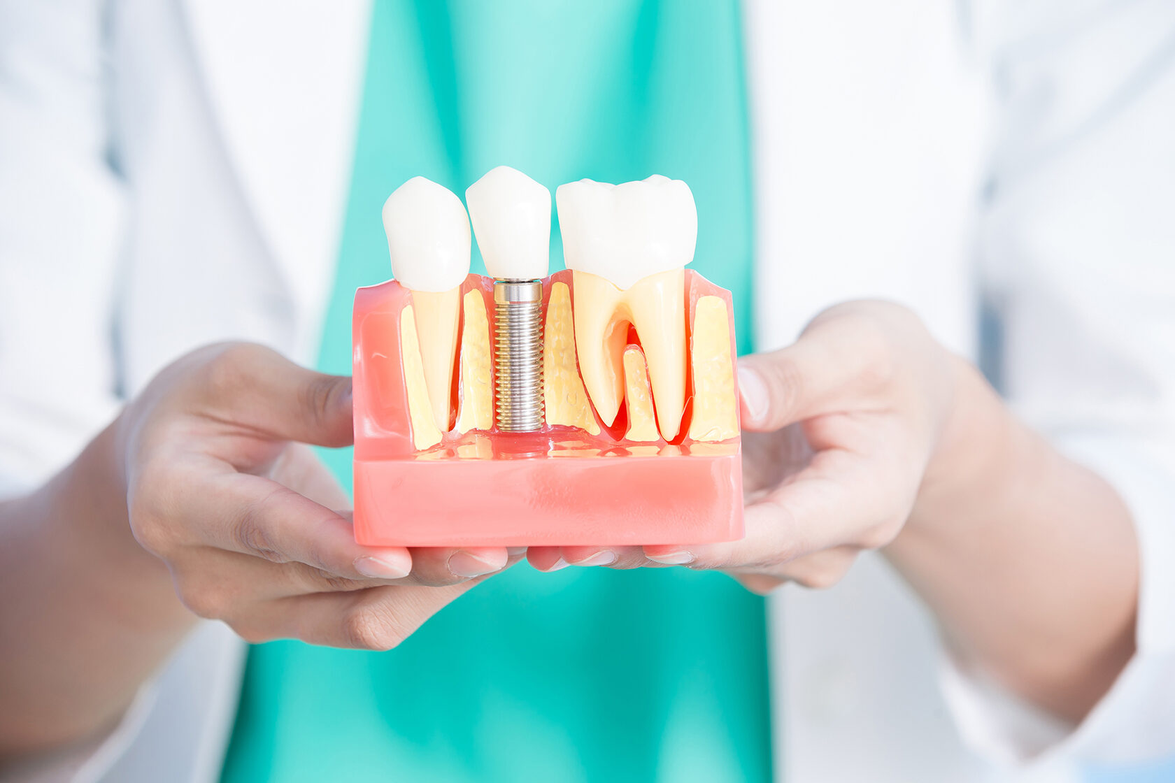 Can Dental Implants Look and Feel Like Natural Teeth