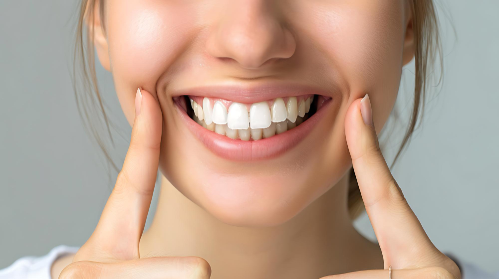 How to Fix a Gummy Smile Naturally and Medically