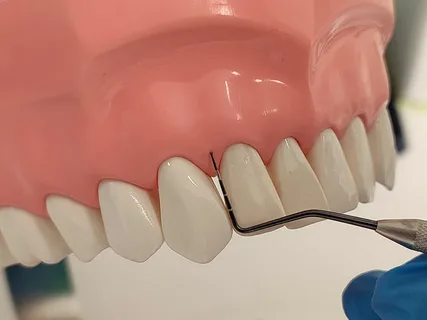 How Can Periodontics Help Save Your Teeth?