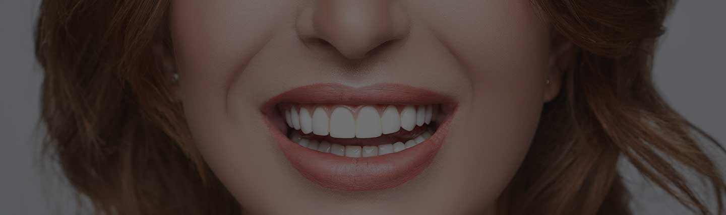 Is Hollywood Smile Design Permanent?