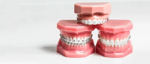 Can Orthodontic Treatment Improve Your Bite and Jaw Alignment?