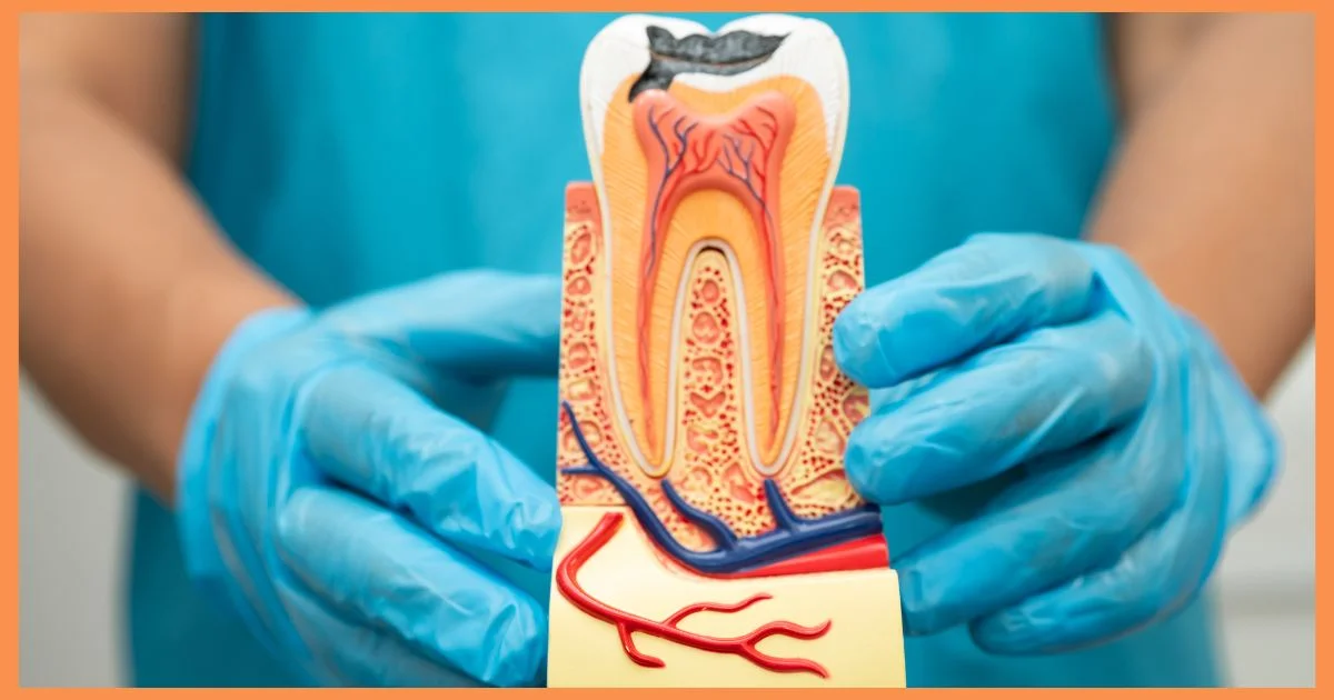 Why 3 sittings for root canal treatment?