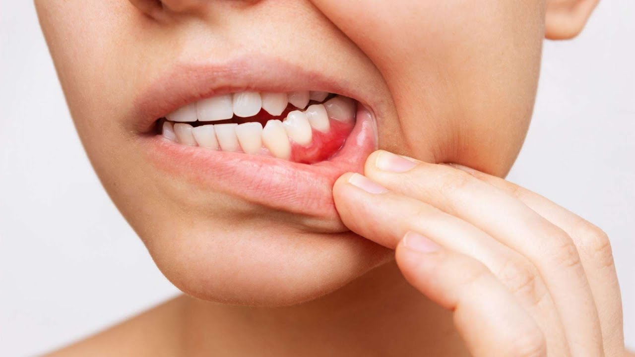 Can gum disease affect the heart?