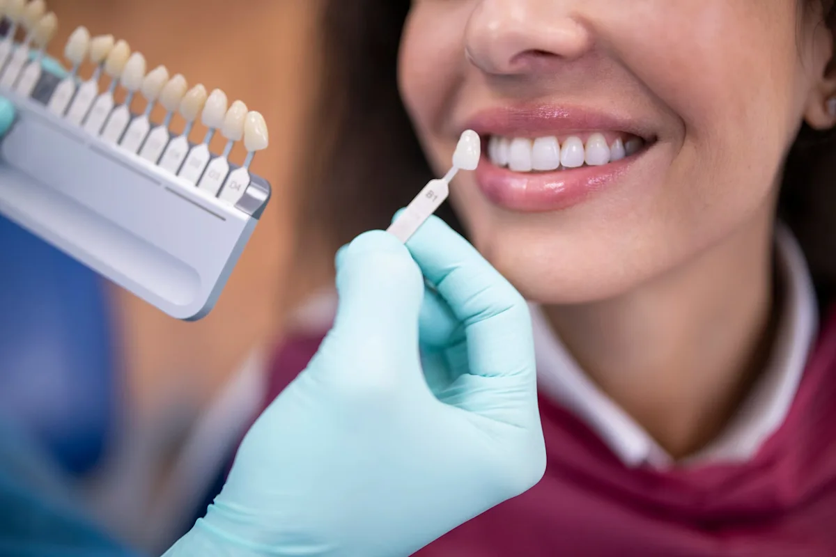 Dental Veneers in Islamabad