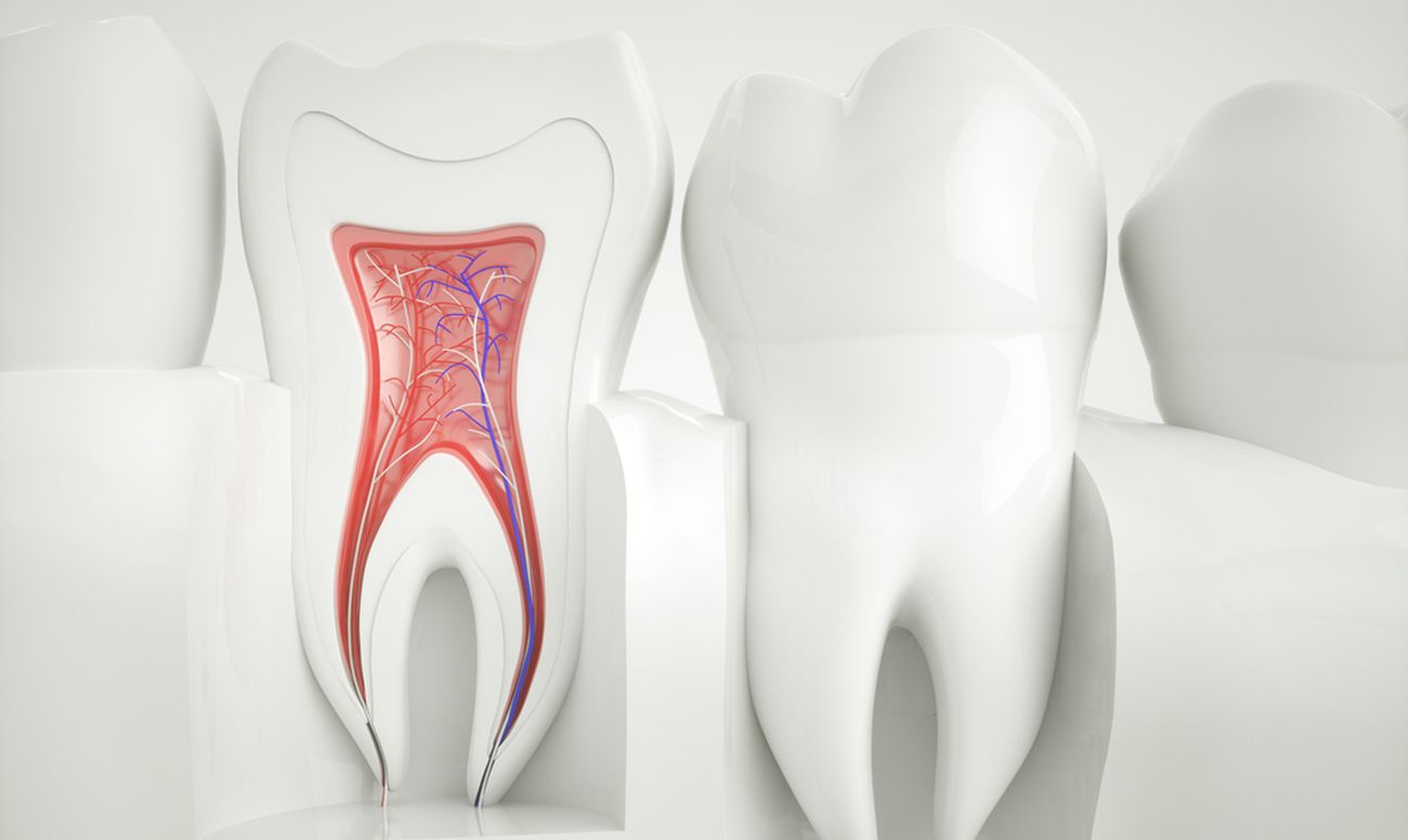 Root canal treatment cost in Islamabad