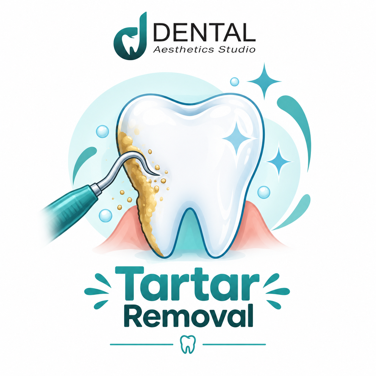 Tartar Removal Cost in Pakistan