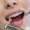 Teeth Whitening Prices in Pakistan