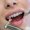 Teeth Whitening Prices in Pakistan